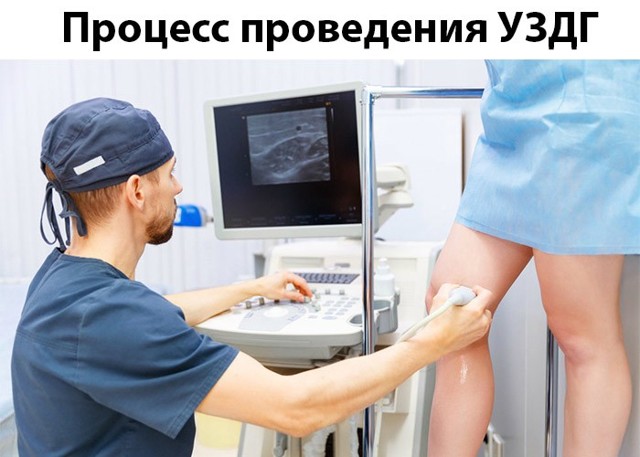 УЗДГ вен нижних конечностей (технологии 2019)