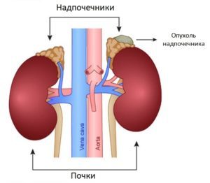 Гипертония 2 степени риск 2