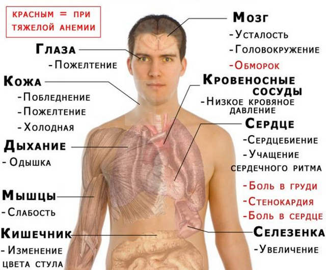 Последствия низкого гемоглобина в крови у женщин и мужчин