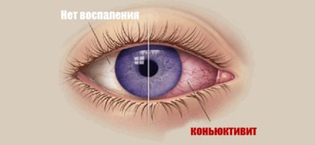 Софрадекс - 7 отзывов, инструкция по применению