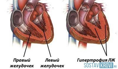 Границы сердца и сосудистого пучка - перкуссия сердца - БГМУ