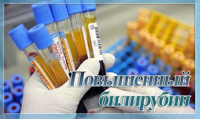Билирубин общий повышен: что это значит у взрослого » Новости Онлайн