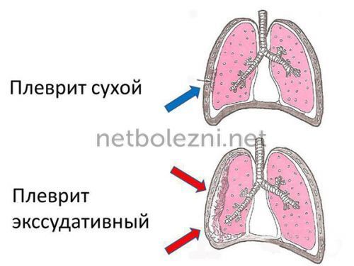 Болит и колит сердце при вдохе: причины, что делать?
