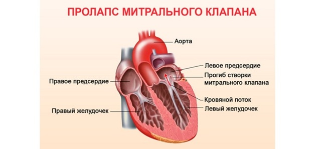 Берут ли в армию с тахикардией в 2019 году?