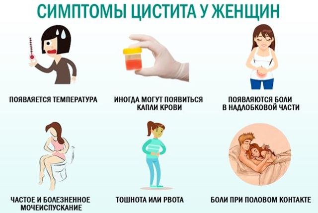 Острый цистит у женщин: симптомы и лечение