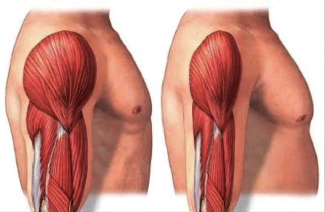 Мышечная гипотония у новорожденных и детей