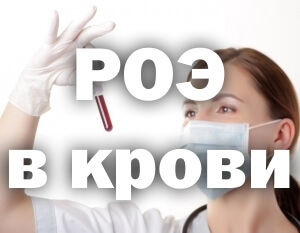 Норма и повышенный уровень роэ в крови у женщин