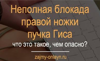 Неполная блокада правой ножки пучка Гиса