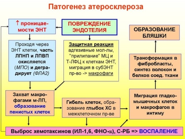 Атеросклеротические стенозы сонных артерий как причина мозгового инсульта - Сибирский медицинский портал