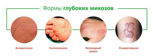 Как избавиться от плесени в ванной комнате? (Рекомендации)