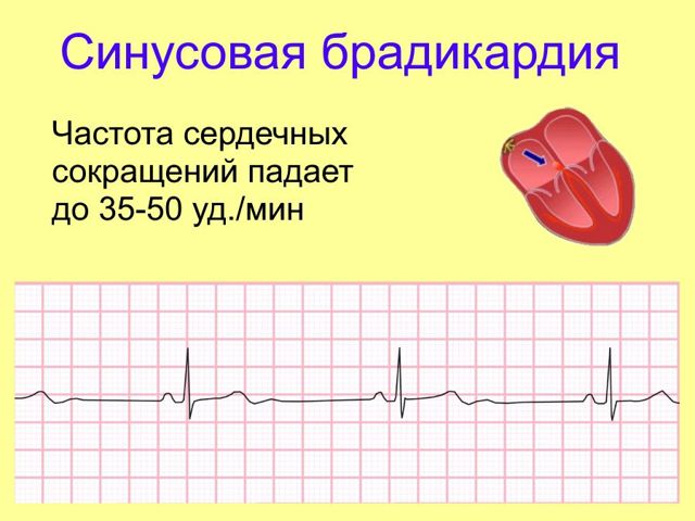 Пульс (ЧСС): нормы у взрослого человека, ребенка, высокий и низкий