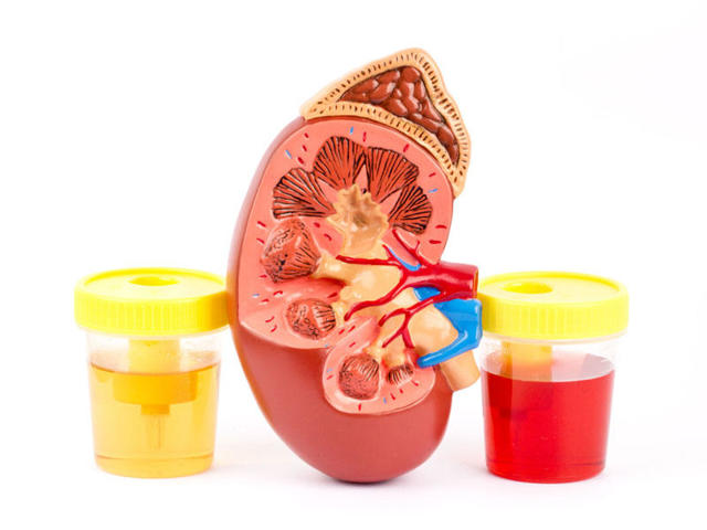 Пароксизмальная холодовая гемоглобинурия. Гемолитические анемии на почве изоиммунных тел.