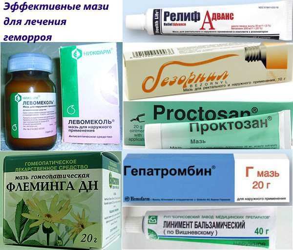 Чем лечить геморрой у женщин при симптомах заболевания