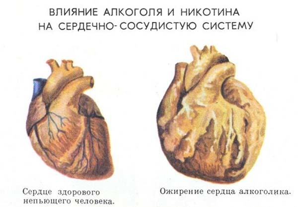 Перестает болеть сердце после алкоголя. Что нужно делать при сердечных болях после алкоголя. После алкоголя болит сердце? Возможные причины и методы лечения