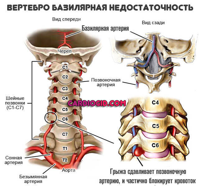 Как и чем повысить верхнее систолическое давление в домашних условиях? Низкое верхнее артериальное давление: причины и лечение