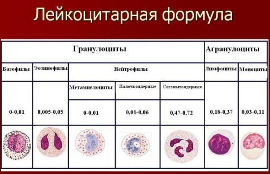 Понижены лейкоциты в крови: что это значит у женщин