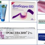 Основные признаки варикоза у мужчин