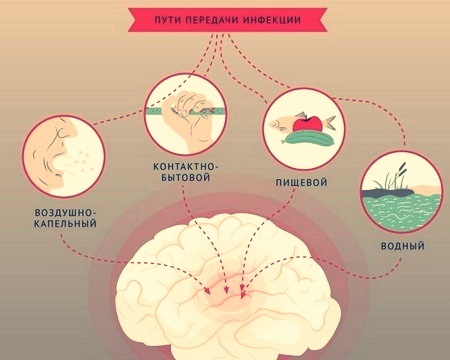 Менингит – симптомы и лечение у детей по видам заболевания