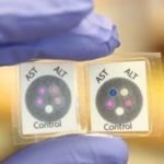 АСТ в крови – какова норма, причины повышения, что означает анализ крови АСТ?