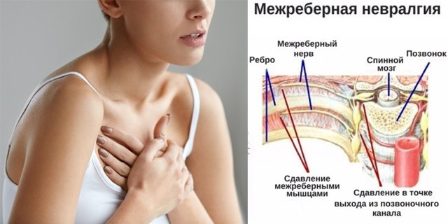 Болит посередине грудной клетки: причины, лечение, диагностика.
