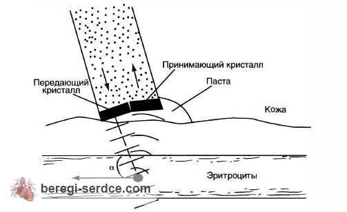 Допплерография и дуплексное сканирование сосудов
