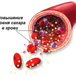 Сахар под контролем: какие продукты нормализуют сахар в крови