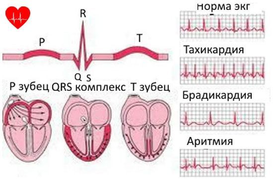 200 ударов в минуту