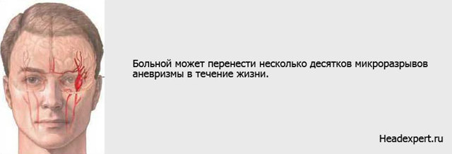 Аневризма головного мозга: что такое, почему возникает, группы риска, классификация, симптомы, осложнения, последствия, диагностика, лечение