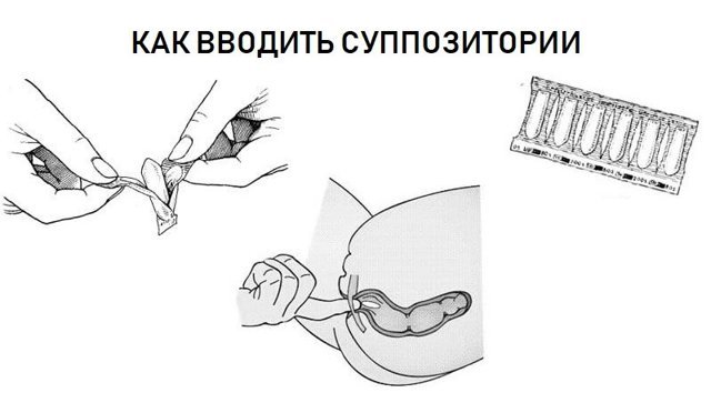Свечи Метилурацил при геморрое: применение, инструкция, аналоги, отзывы и цены