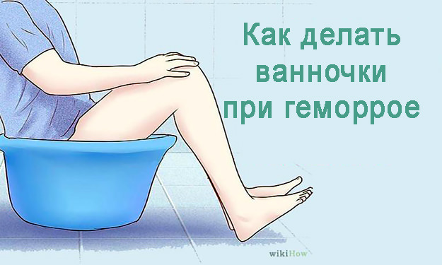 Лед при геморрое - можно прикладывать? •●Компрессы Примочки Ванночки●•