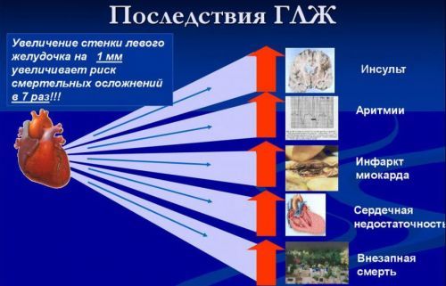 Позиция сердца вертикальная: как выглядит, признаки заболевания, расшифровка, что это