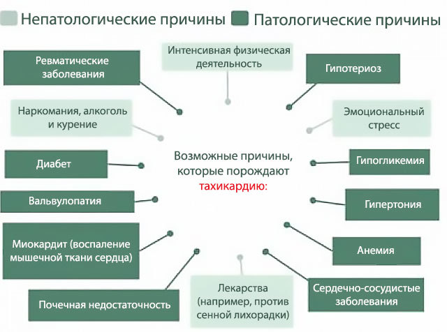 Берут ли в армию с тахикардией в 2019 году?