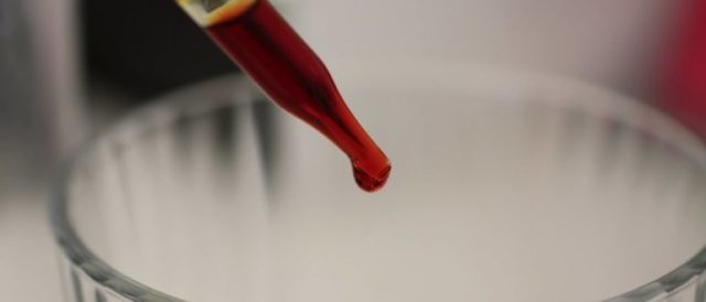 Лечение гипертонии йодом (по индийскому методу)