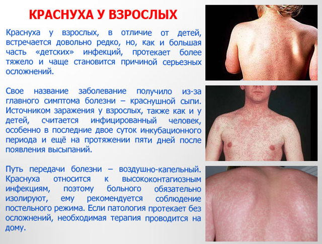 Краснуха у взрослых, лечение, фото и симптомы