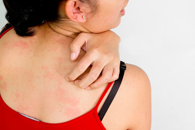 Дермовейт мазь и крем: инструкция по применению, отзывы, аналоги