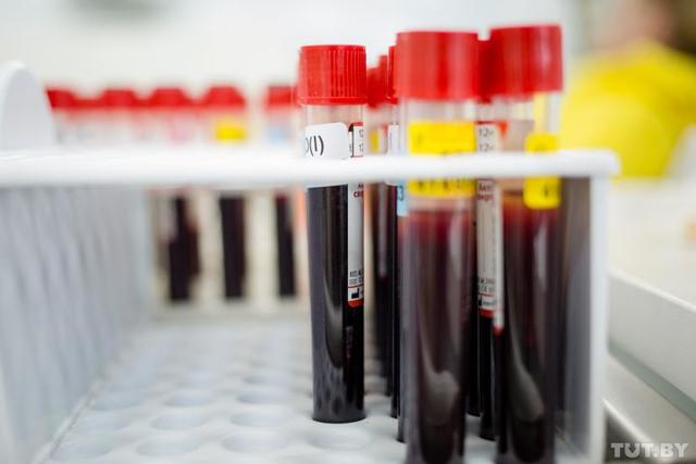 Повышены тромбоциты и повышены лимфоциты