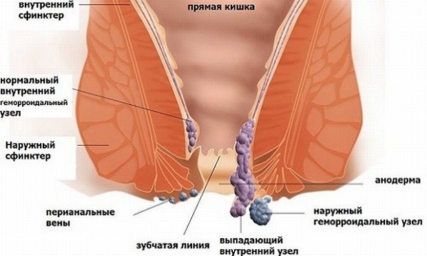 Ихтиоловые свечи - инструкция по применению