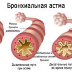 Адреналин – инструкция, показания, применение