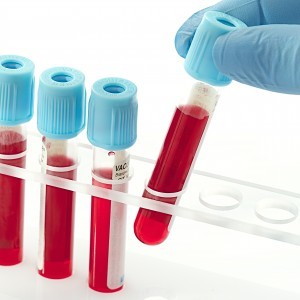 Как обозначается группа крови при сдаче анализов?