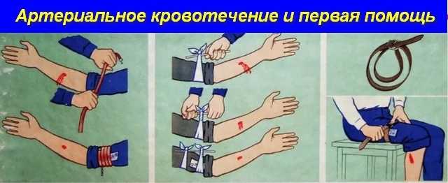 Первая помощь при кровотечениях