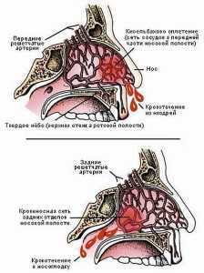 Кровь из носа: причины у взрослых и детей, как остановить кровотечение