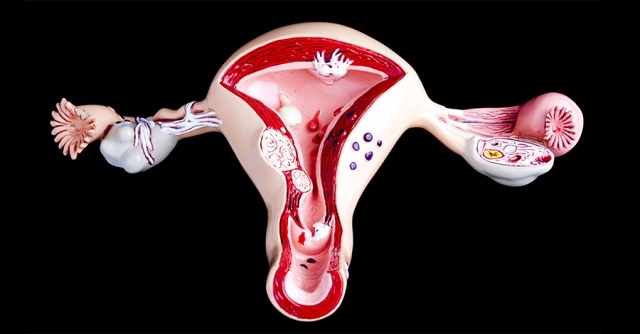 Как остановить маточное кровотечение в домашних условиях?