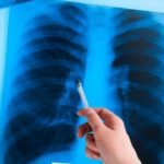 Уколы Дипроспан: инструкция по применению, цена, отзывы и аналоги