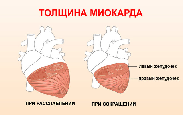 Индекс массы миокарда норма