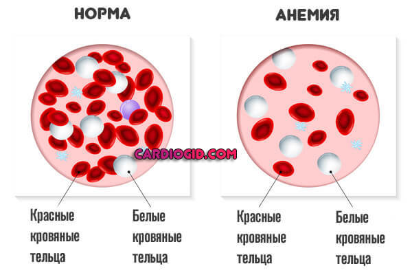 Как и чем повысить верхнее систолическое давление в домашних условиях? Низкое верхнее артериальное давление: причины и лечение