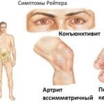 Цель Т инструкция, отзывы, цена, описание