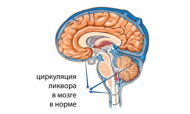 Как понизить внутричерепное давление быстро и просто?