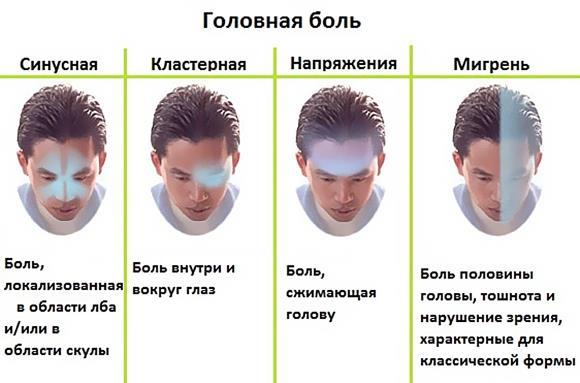 Всё о головной боли: характер, виды, первичная, вторичная
