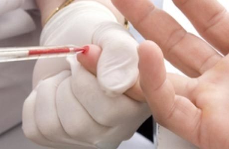 О чем это говорит, если базофилы повышены у взрослого