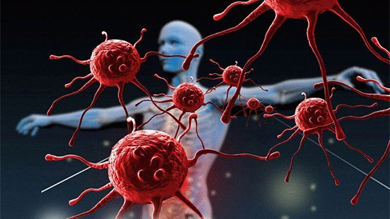 Острый, язвенно-некротический гингивит Венсана: лечение, симптомы и диагностика